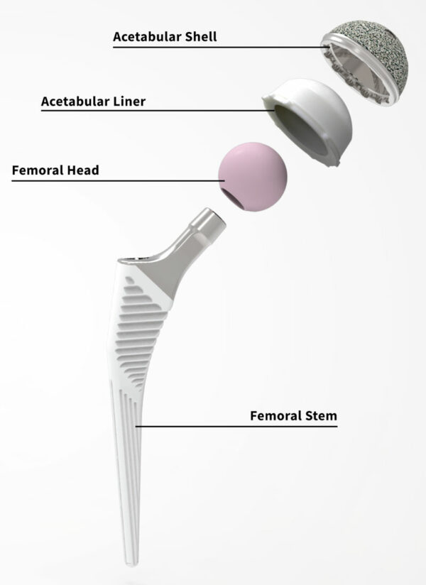 Patient Information – Hip – Signature Orthopaedics